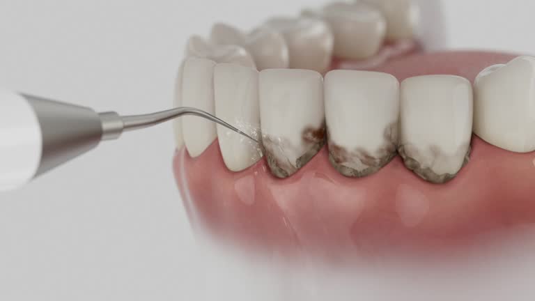 Reliable Teeth Cleaning And Checkup contractor in Leake County County, MS by Dentist Open Now